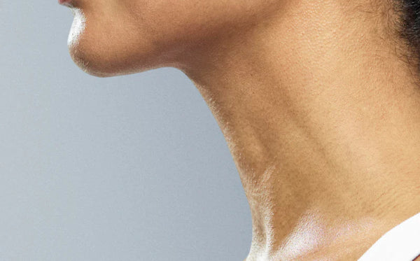 Woman's neck after using natural neck tightening treatments for turkey neck