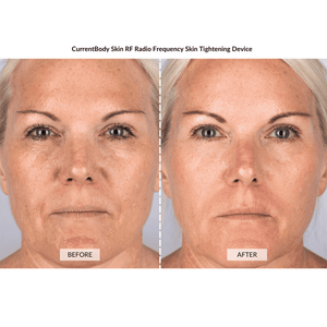 CurrentBody Skin Complete Anti-Ageing Facial Kit